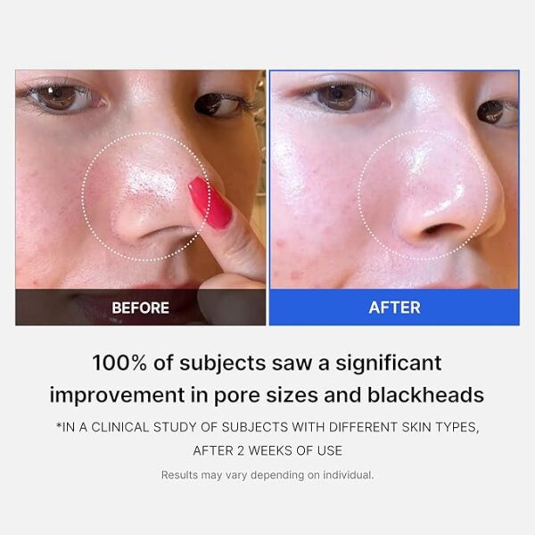 Facial Toner Pads for Exfoliation - Image 2